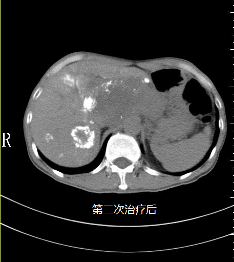 ny08_588229.png v16.png