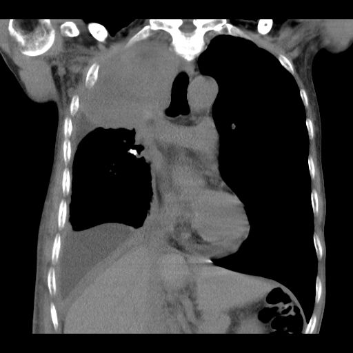 ny06_291883.png d2.png