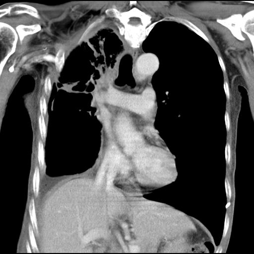 ny06_976248.png d3.png