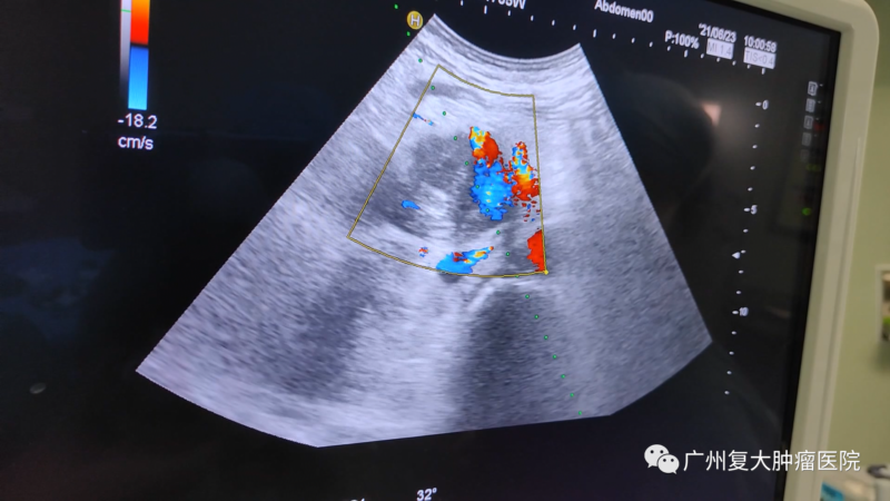 ny08_223782.png 25 (800x450).png