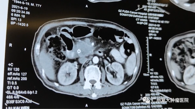 ny08_542965.png 21.png