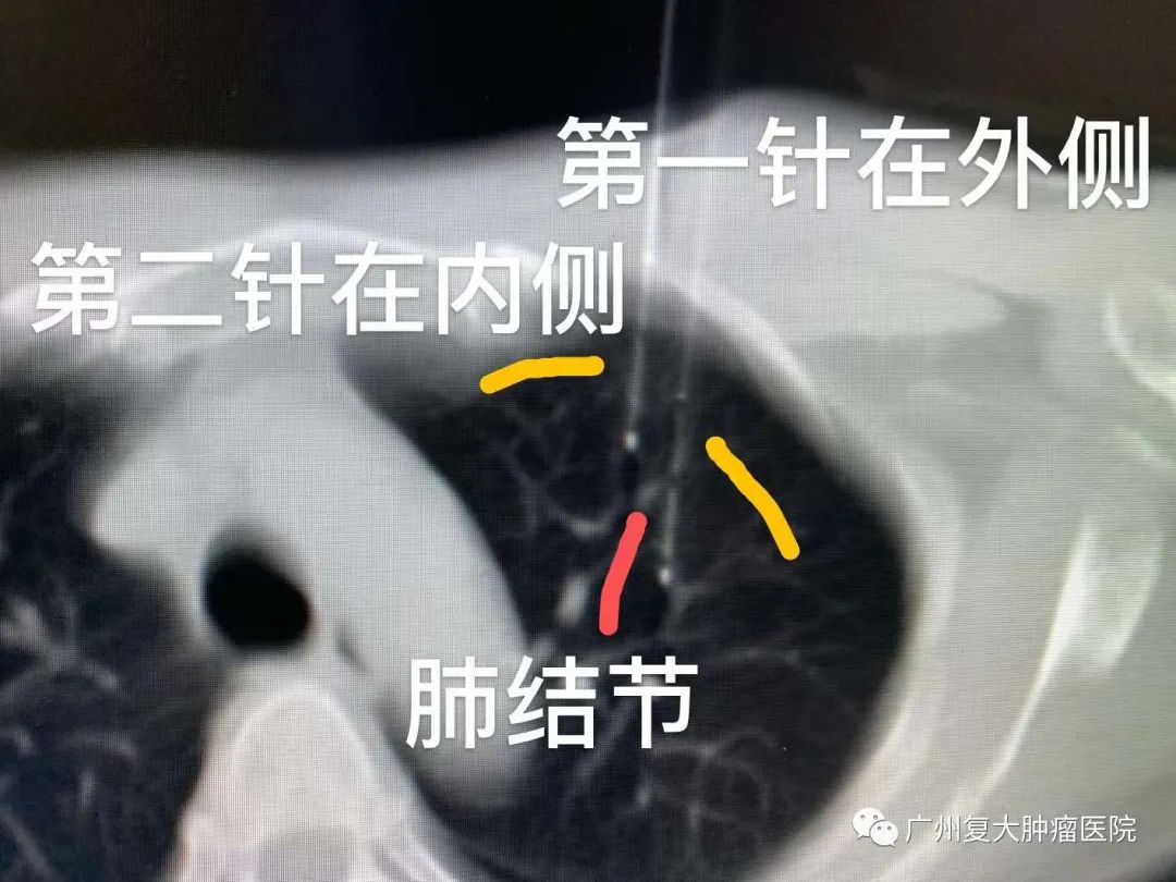 ny04_884799.jpg xx4.jpg