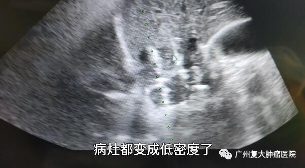 ny27_302867.jpg bb6.jpg